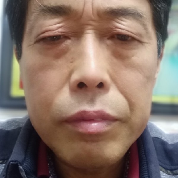 泪雨演变爱笑的照片
