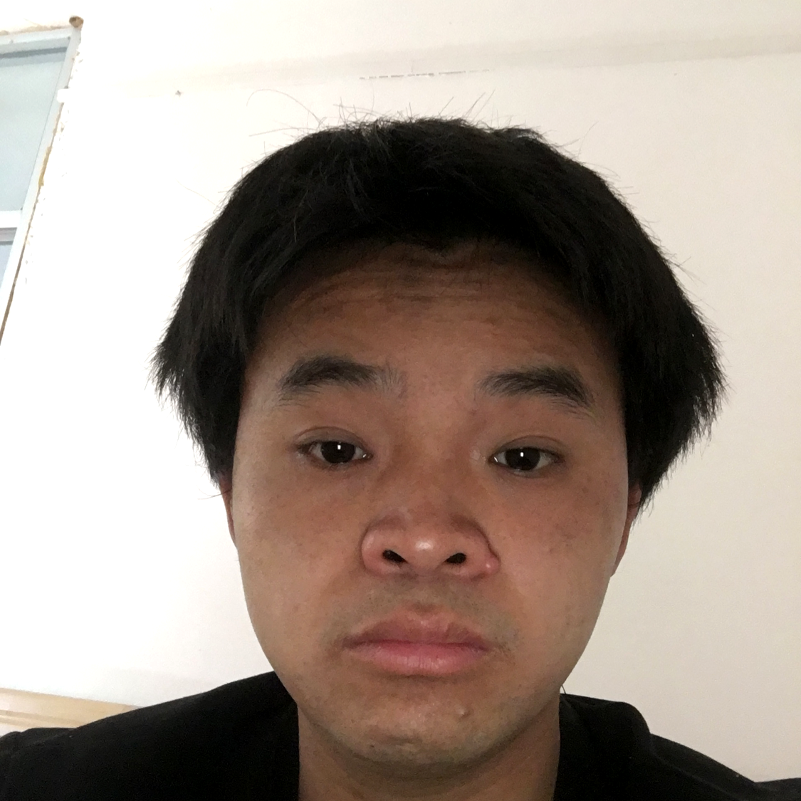 烂漫向小刺猬的照片