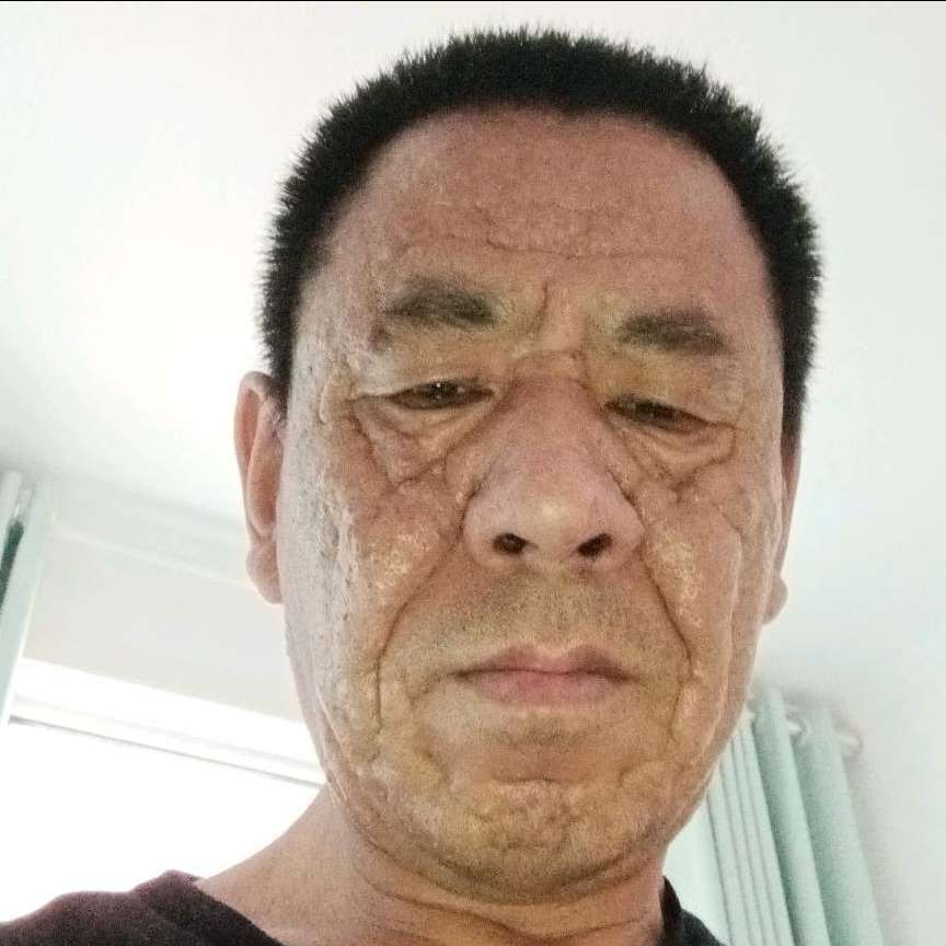 开放泪了玫瑰的照片