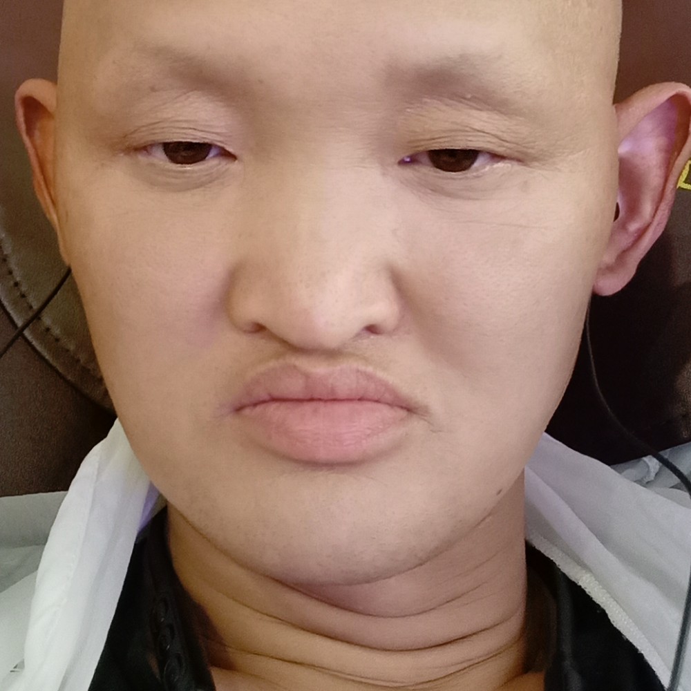 庄中亮的照片