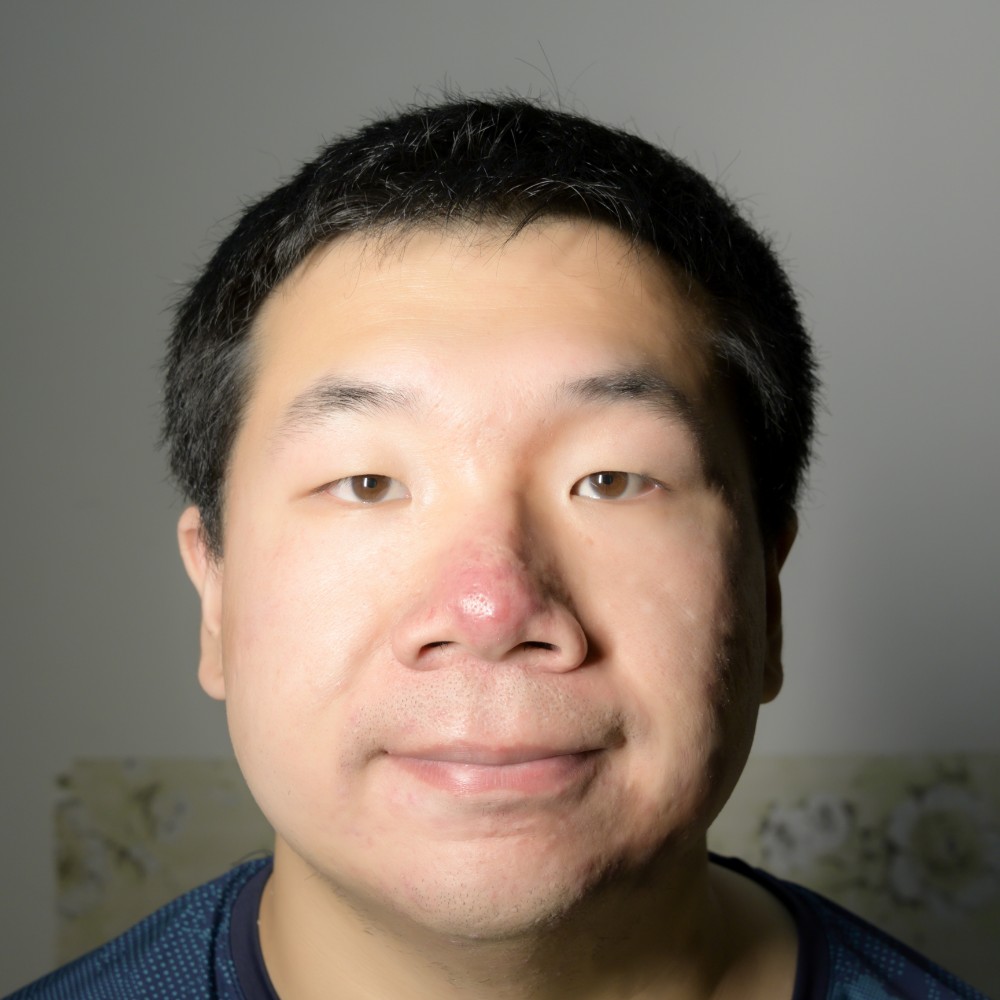 犹格泡泡的照片