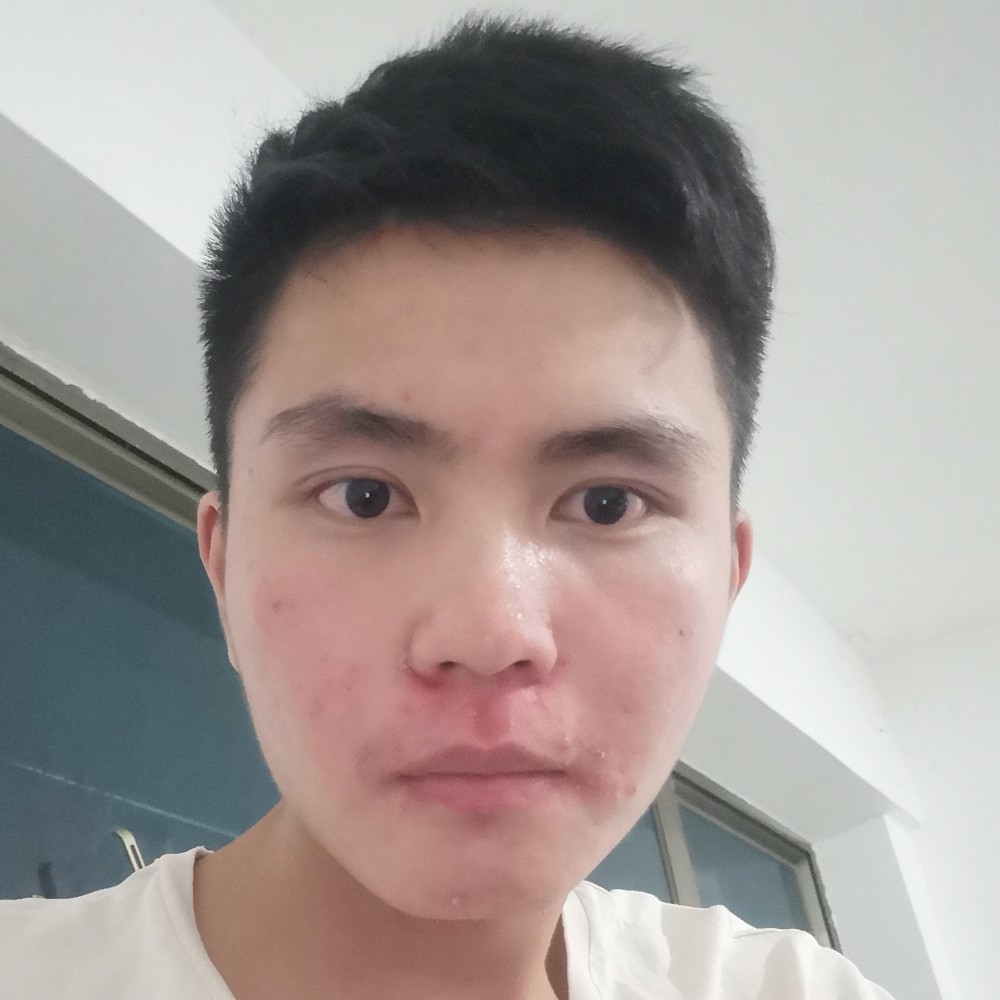 治愈兮的照片