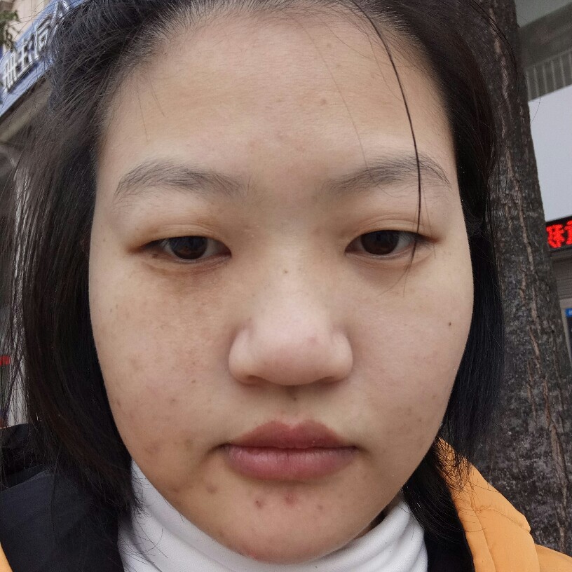 直率半夏的照片