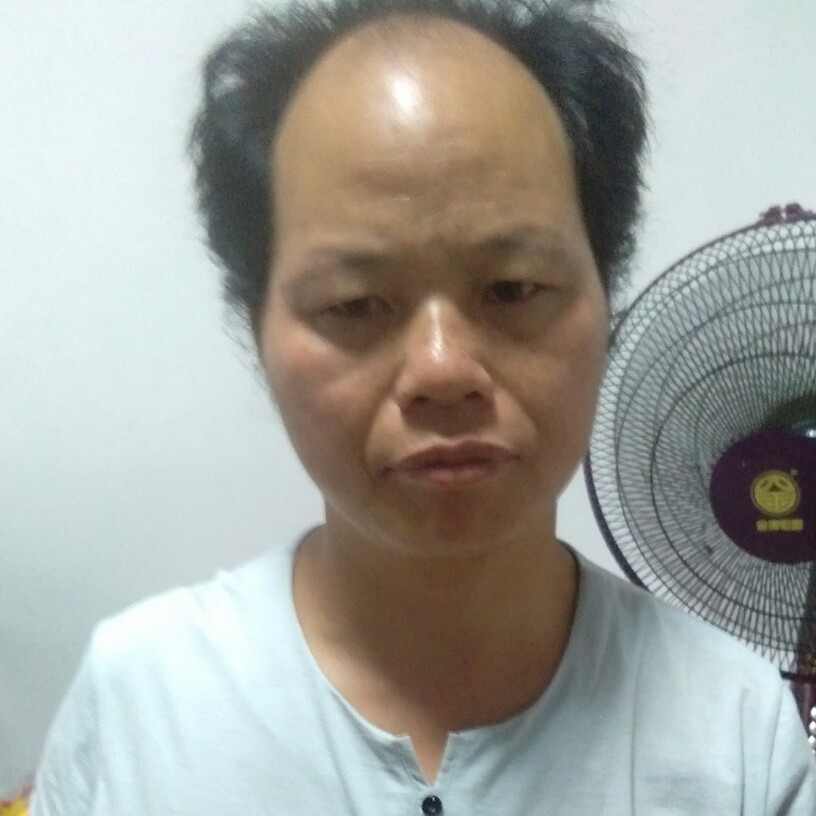 情动香蕉的照片