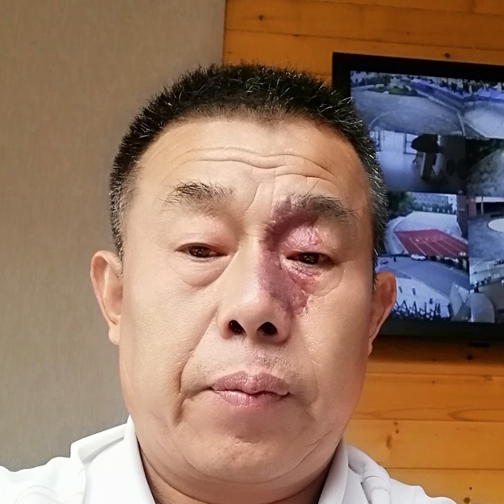 往事漫步危机的照片