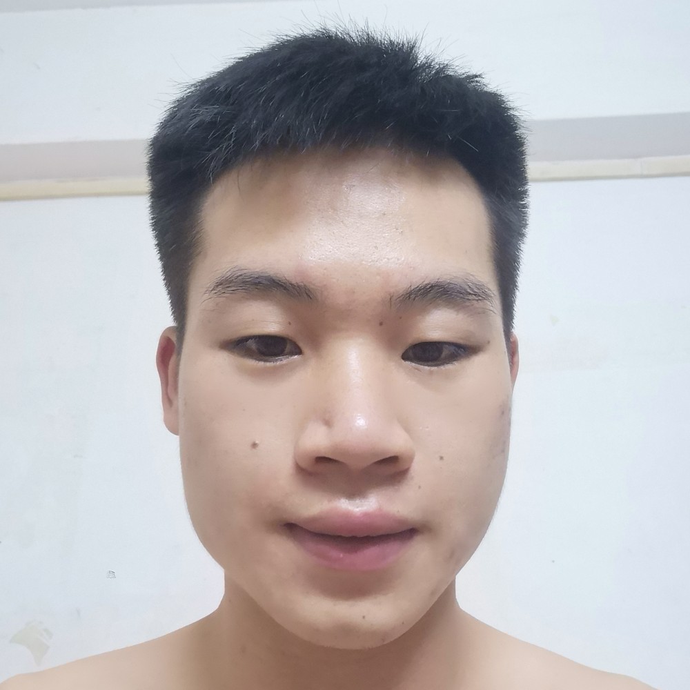 从X开始的照片