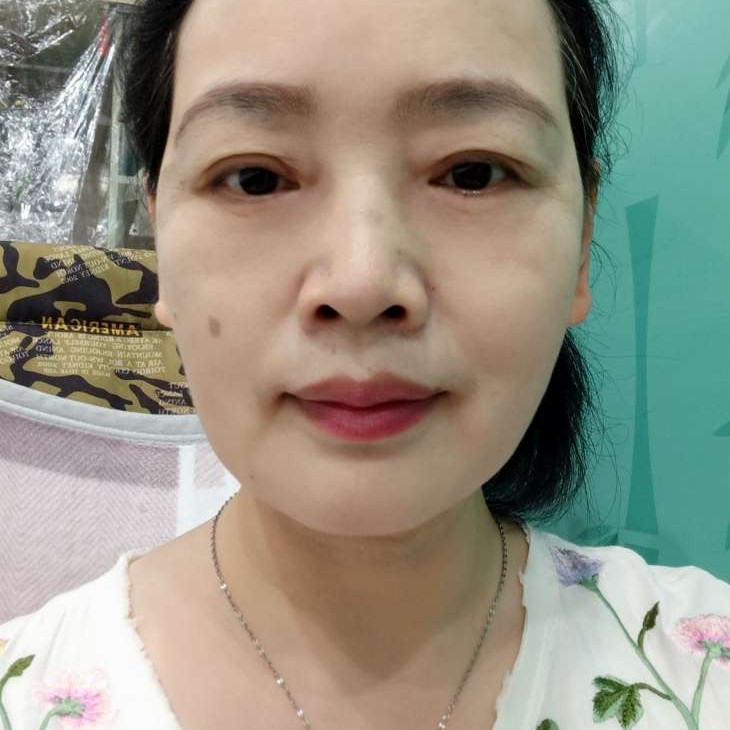 酒唇的照片