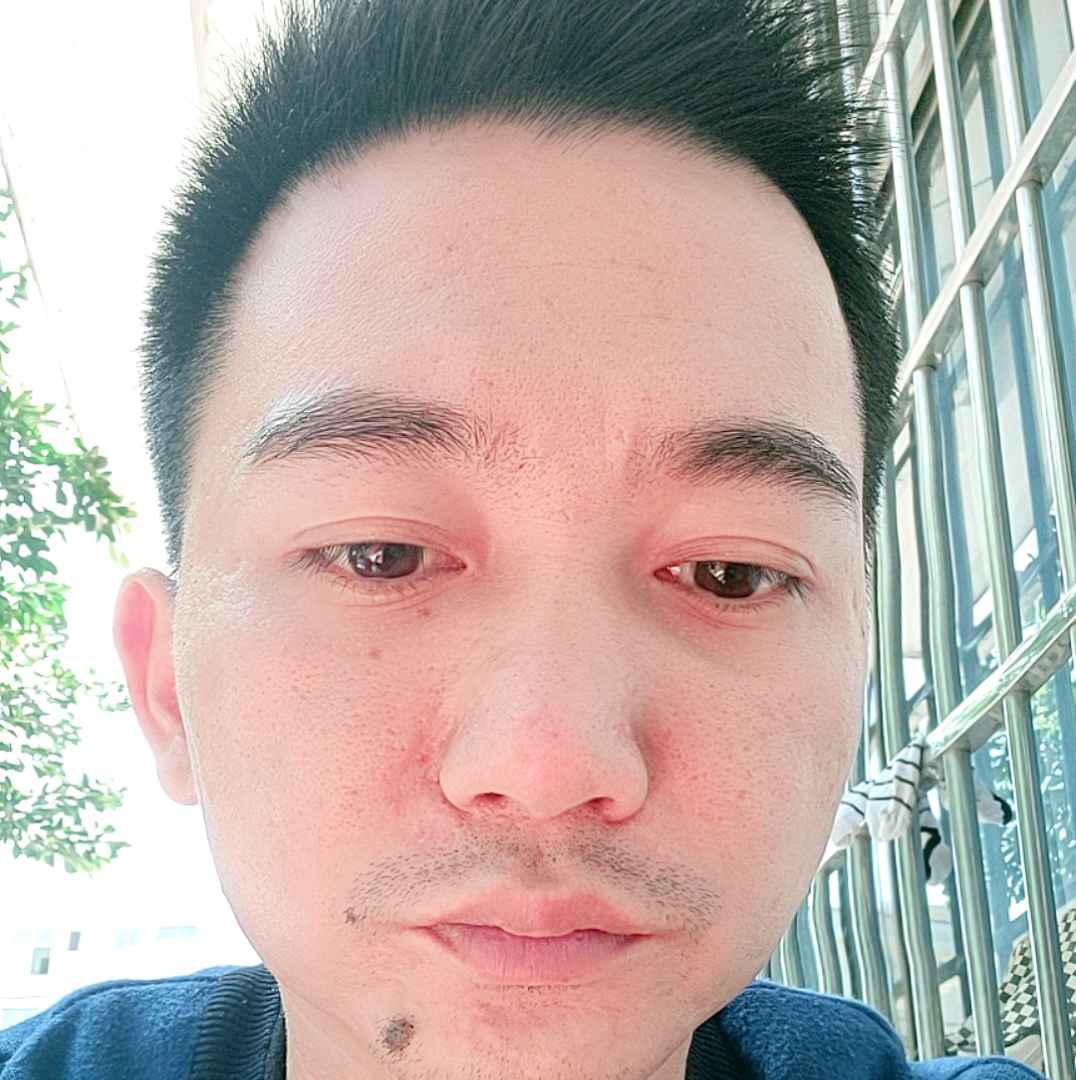 夏露给矮小的照片