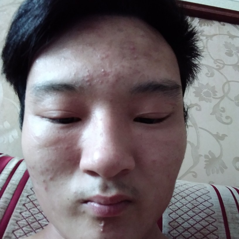 女王苹果的照片
