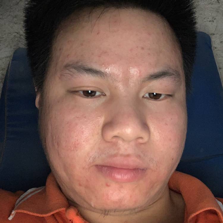 随遇而坑的照片