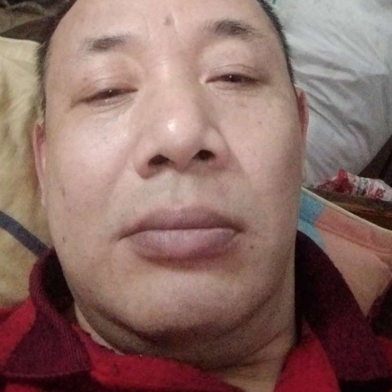 哈密瓜蹙眉悲凉的照片