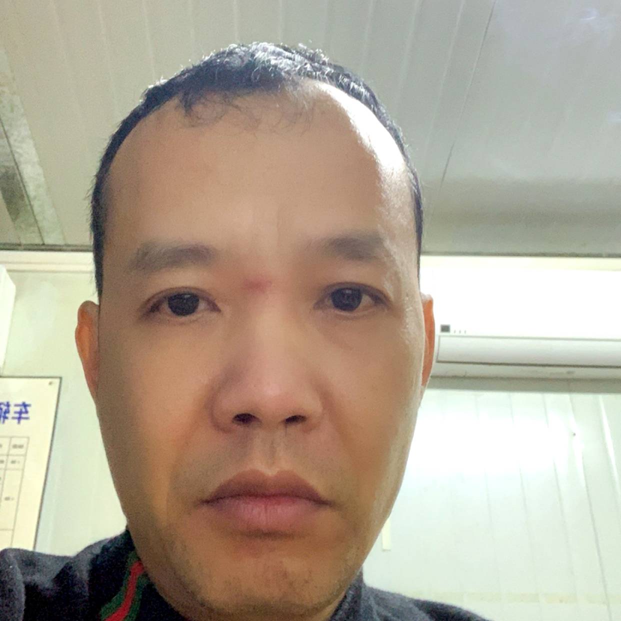 豆芽迎无情的照片