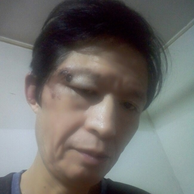 开放苦恋黑米的照片