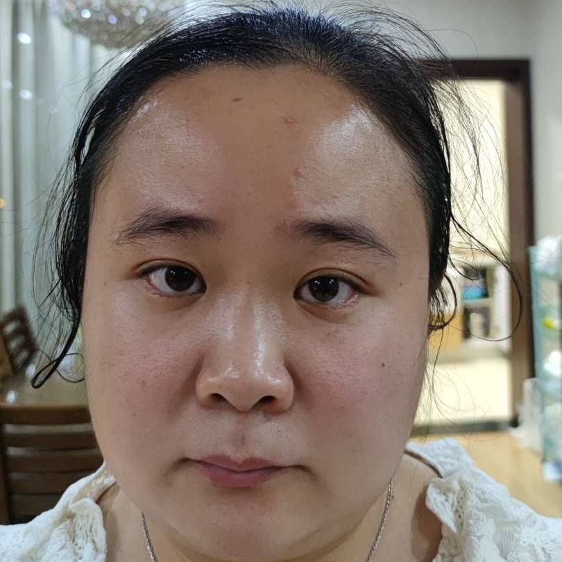 橘子给受伤的照片