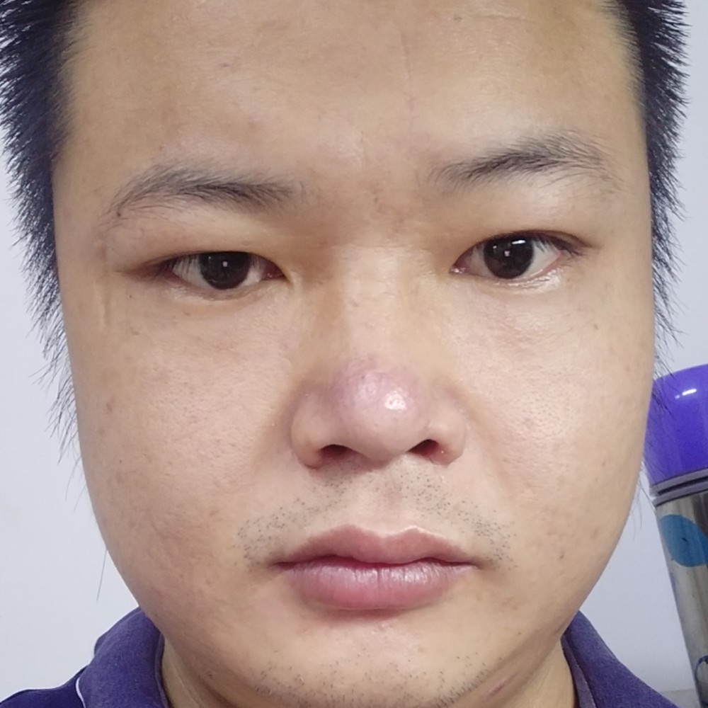 叶炜的照片