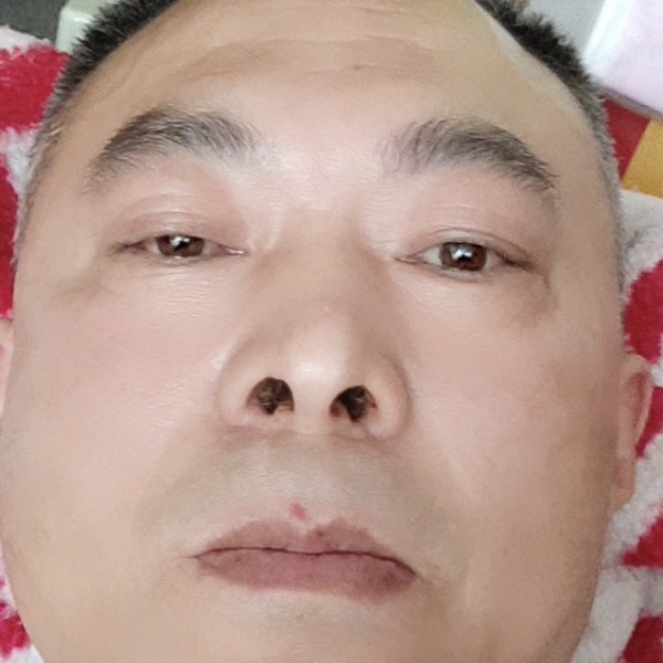 激昂的手套的照片