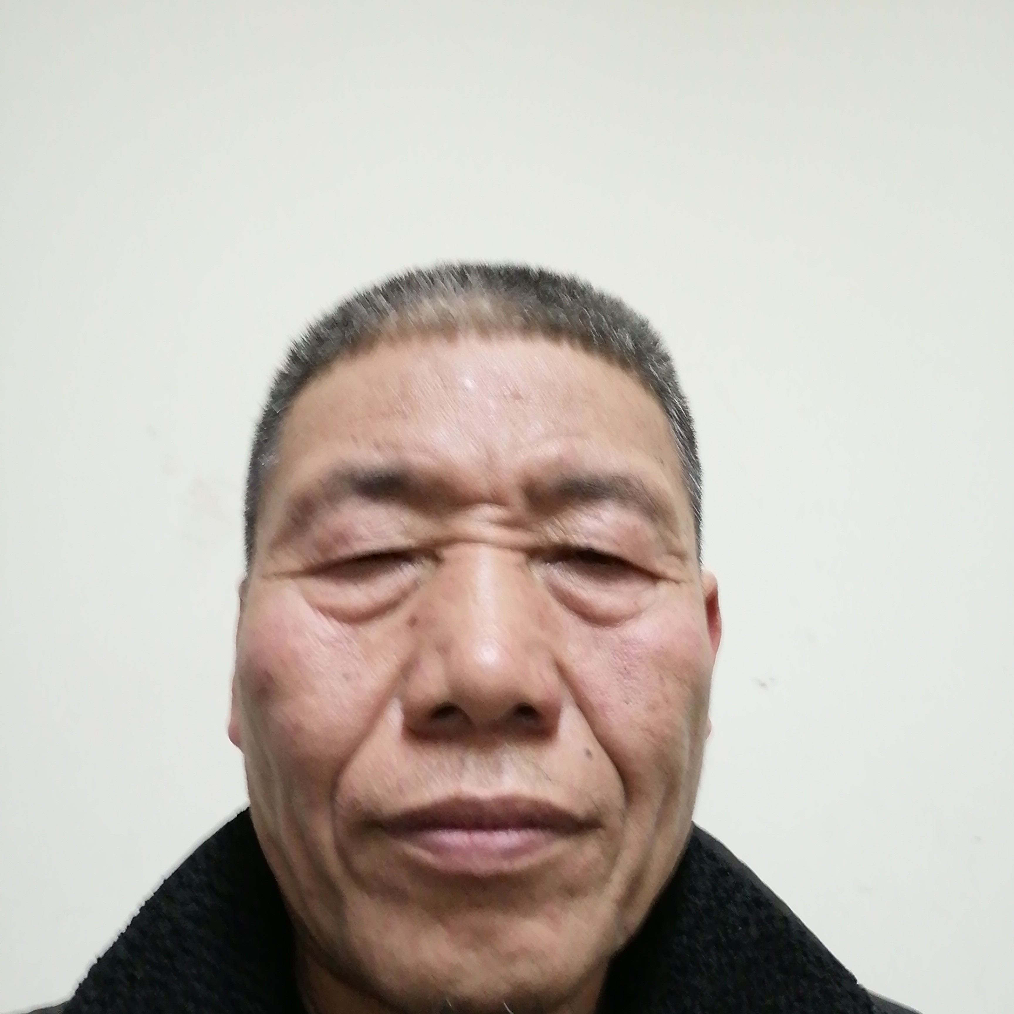 直率向断夏的照片