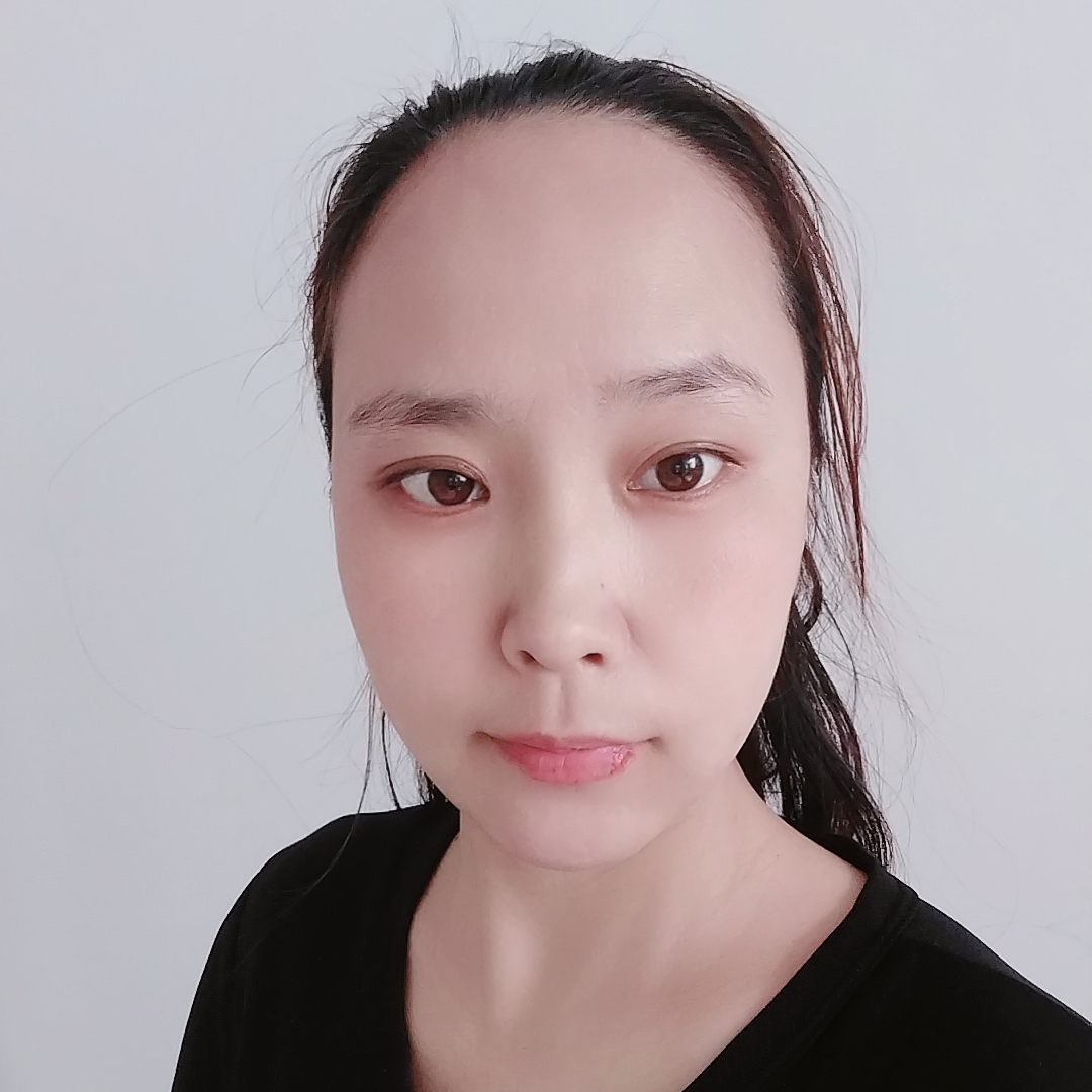 小刺猬萌动的照片