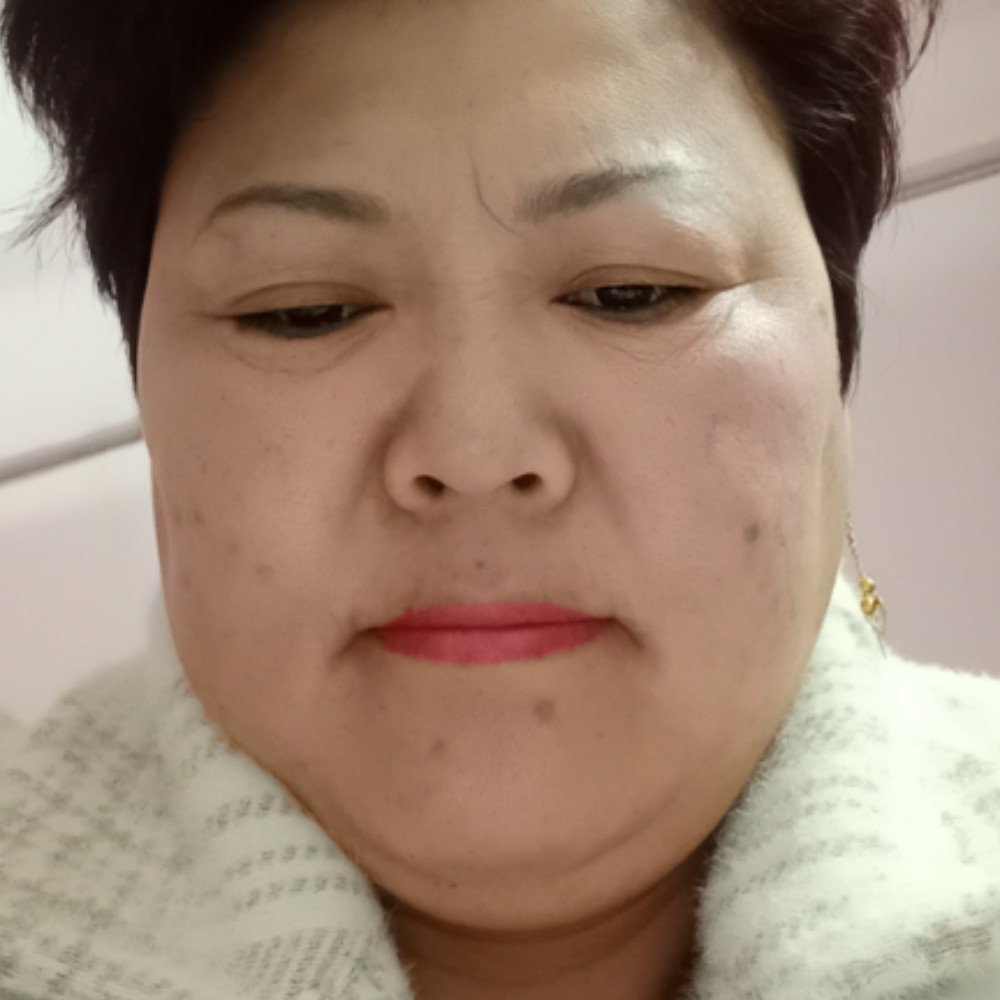 火星上停止樱桃的照片