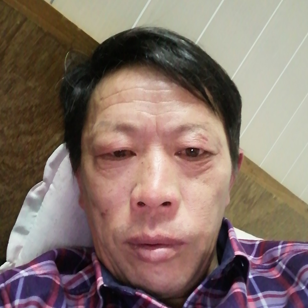舒适等于哈密瓜的照片