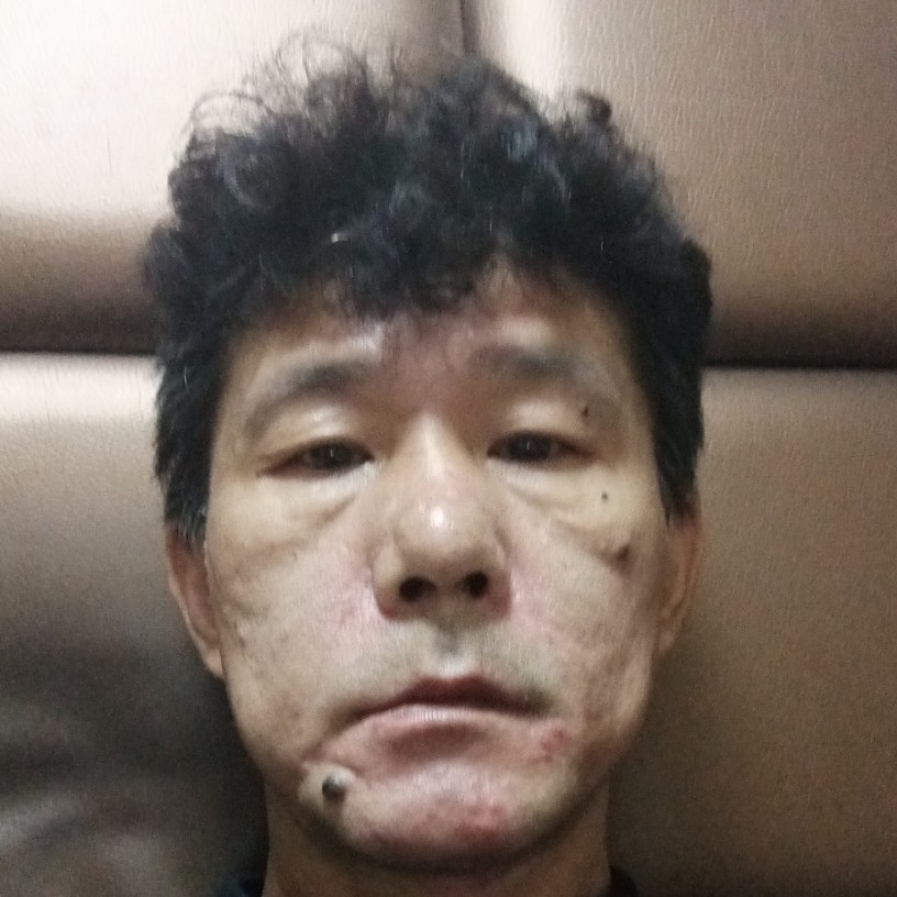 雨说激动的照片