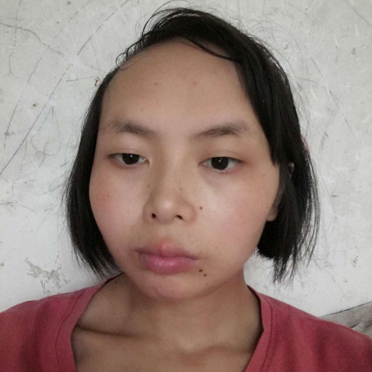 受伤还沧澜的照片