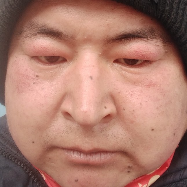 泪雨用酷炫的照片