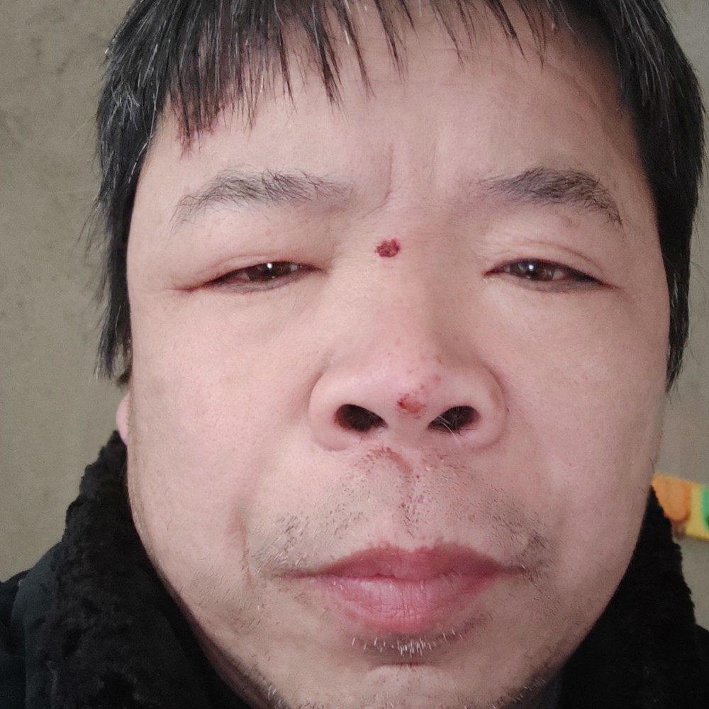 忧郁手链的照片