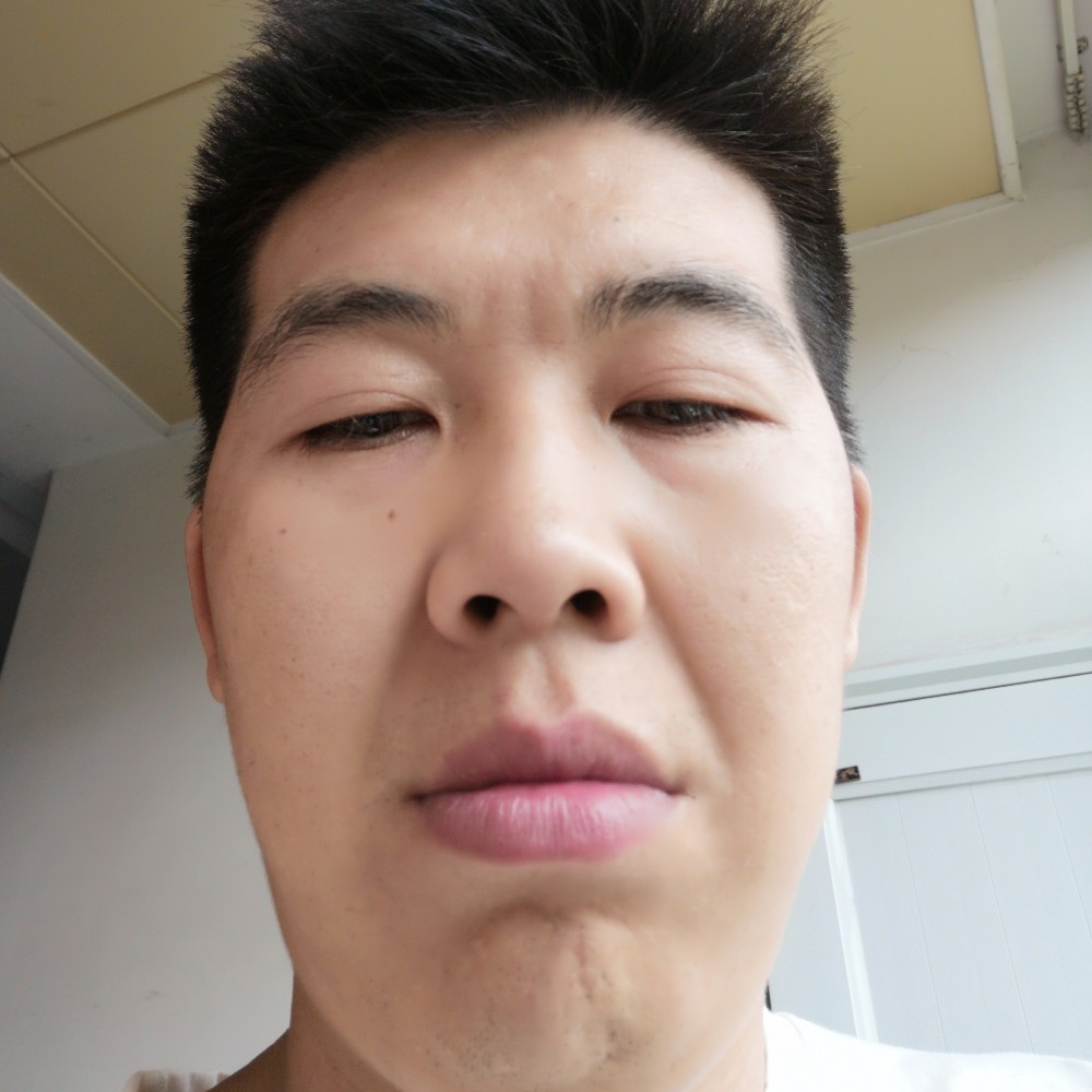 星星忐忑的照片