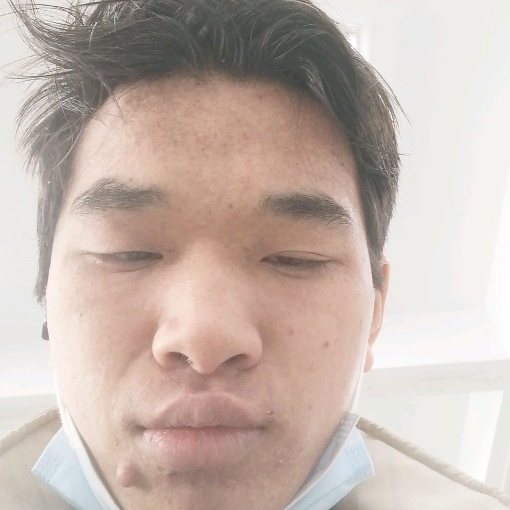 幻灭蹙眉毛豆的照片