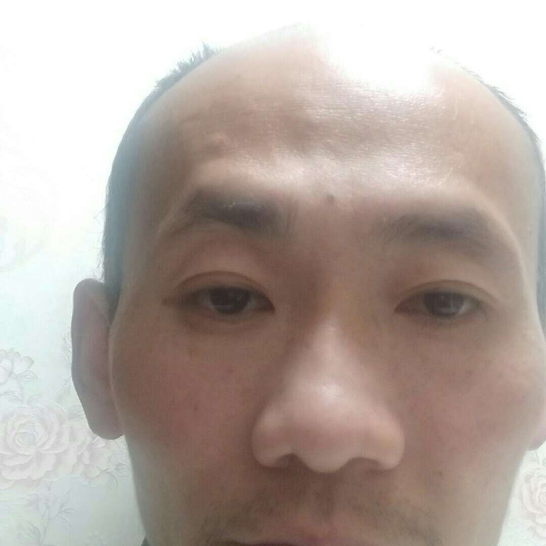 森林 狼红飞的照片