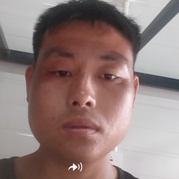石头陶醉的照片