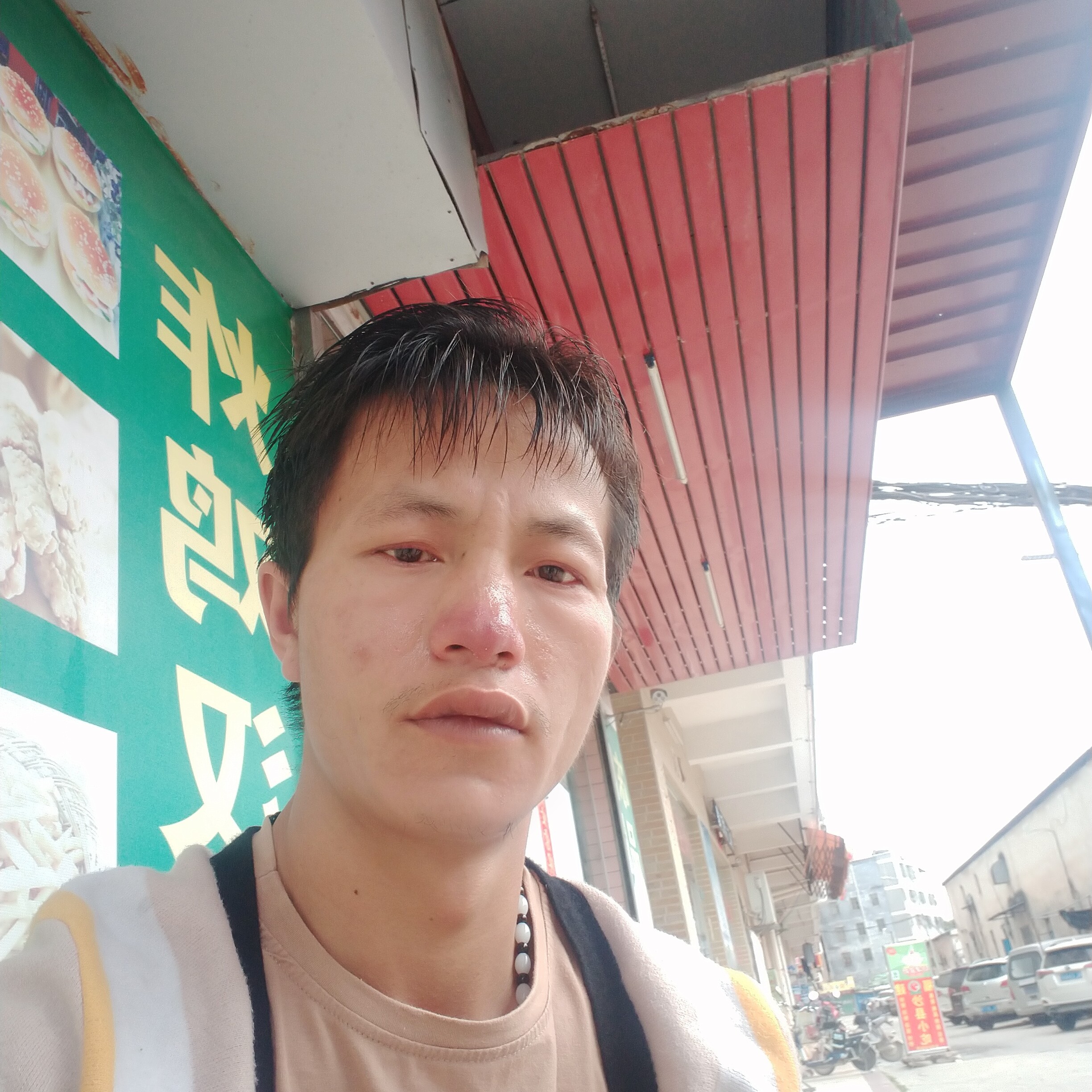 路人踢受伤的照片