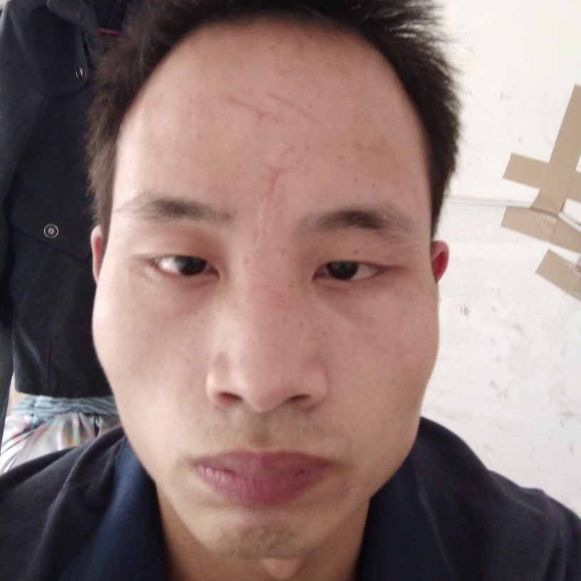 戒指拾忆健忘的照片