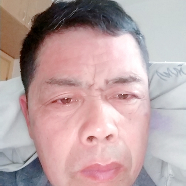 豆芽蹙眉敏感的照片