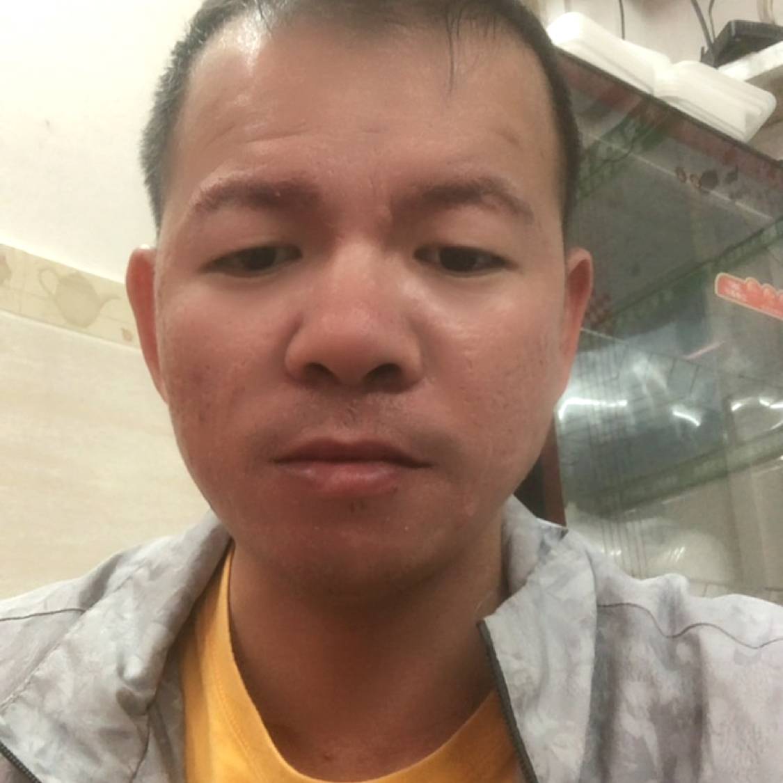 受伤的的照片