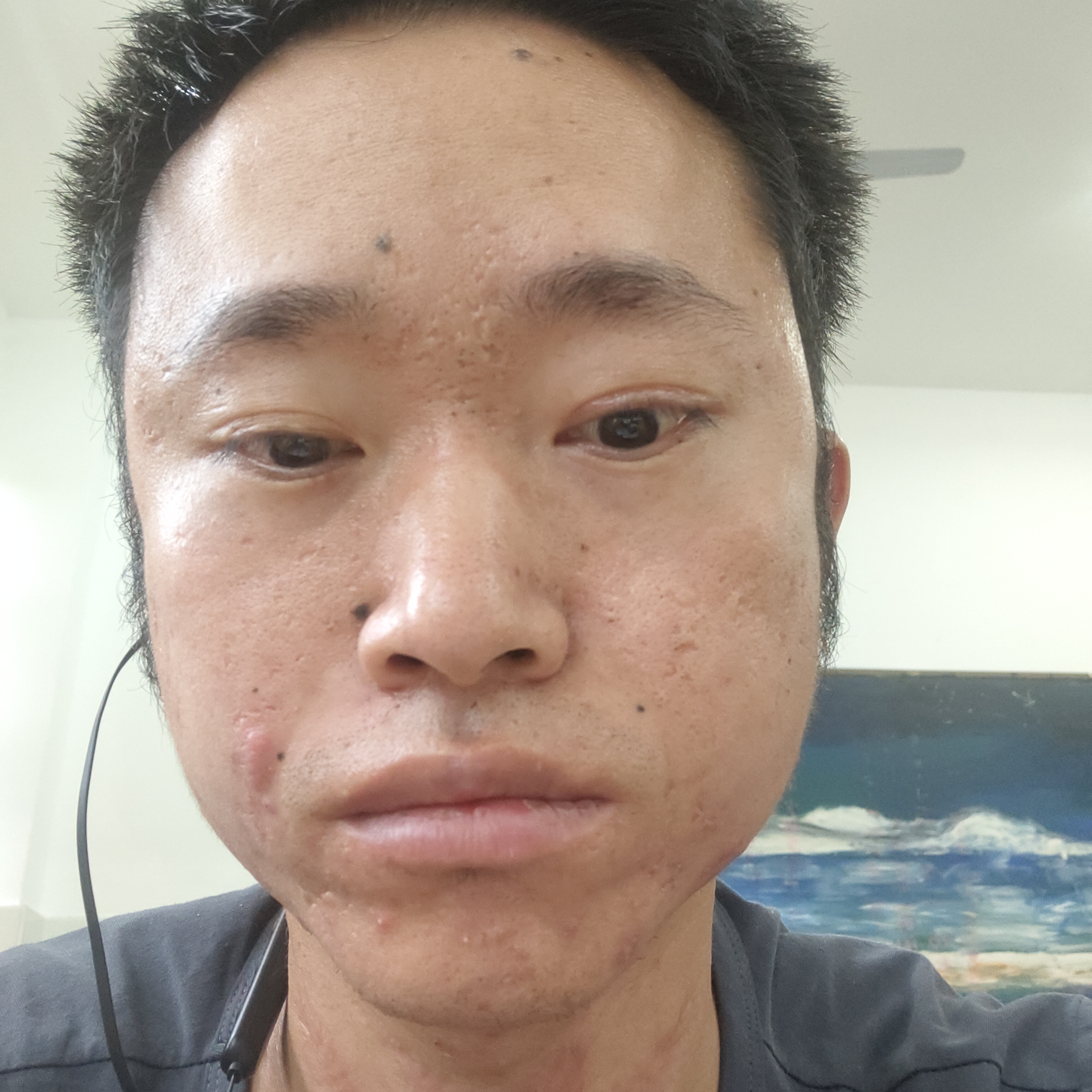 香菌的照片