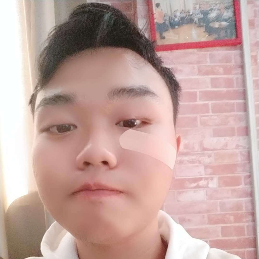 耳又又的照片