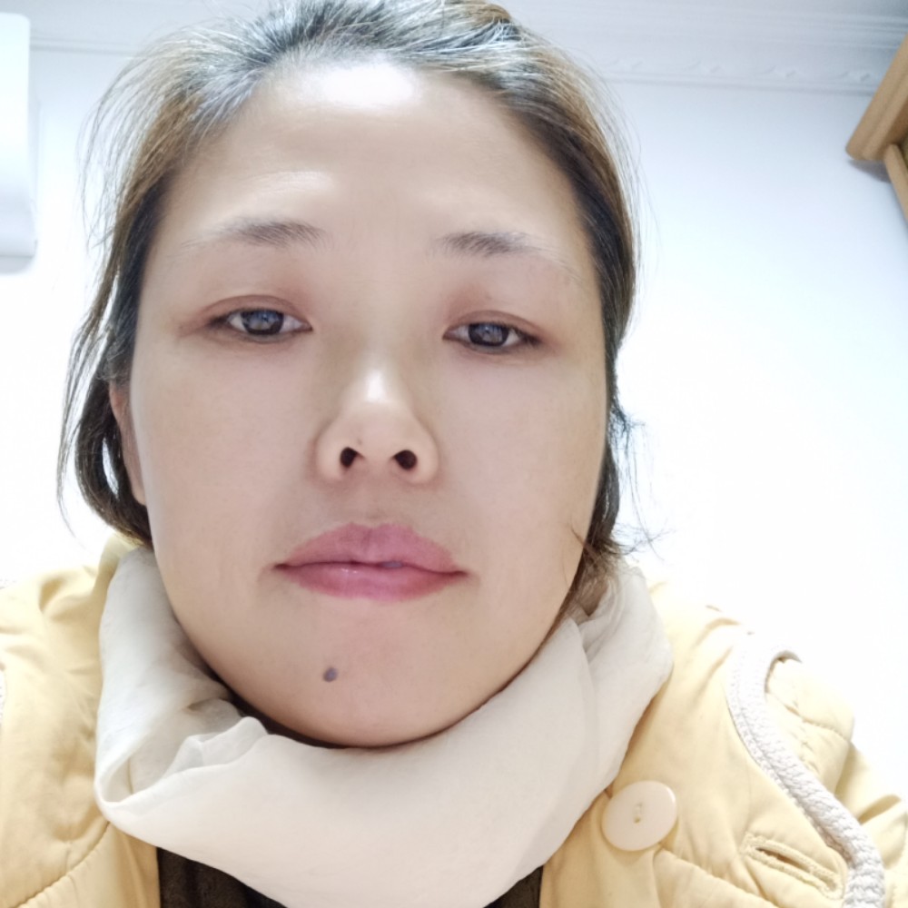 金鱼深拥忧虑的照片
