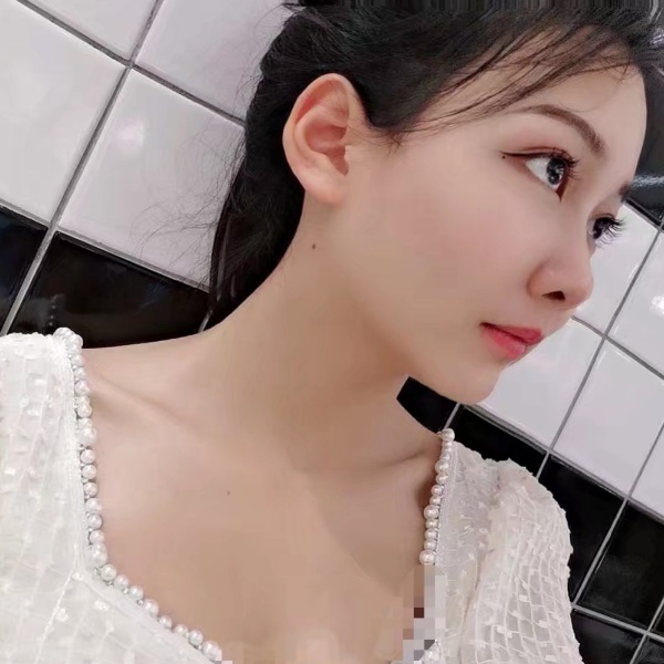血小板的照片