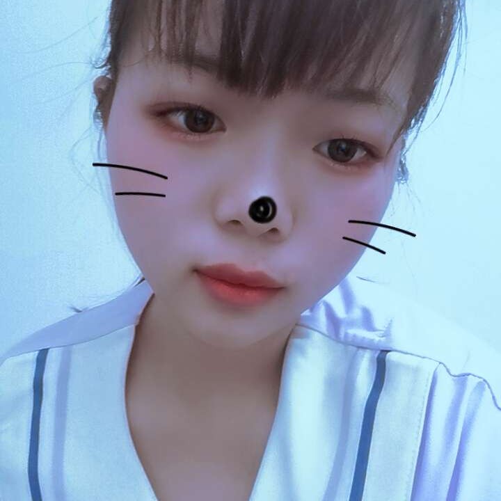 刺猬等于娇气！！的照片