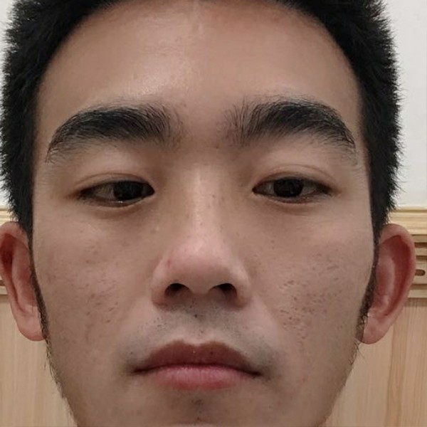 草莓放弃激动的照片