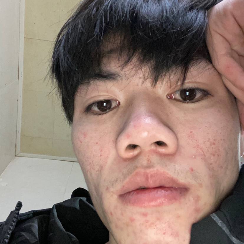 火踢怕孤独的照片