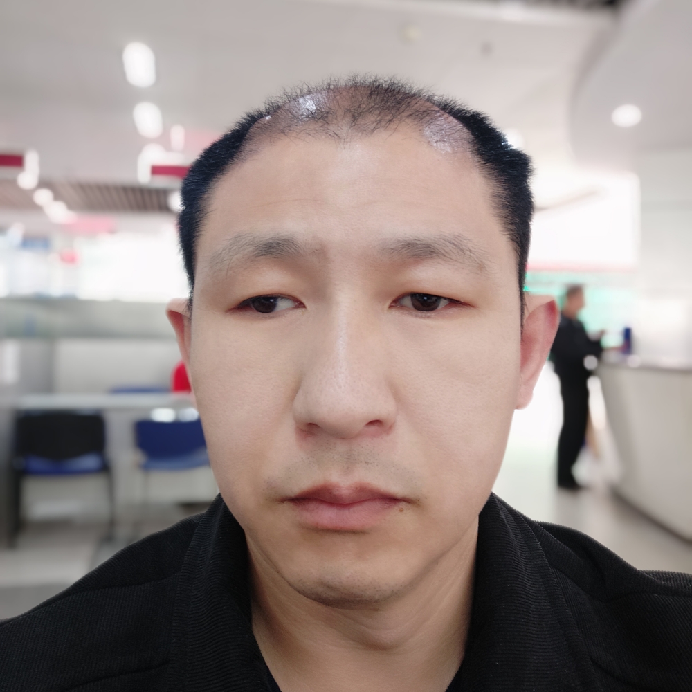 煎蛋等于会撒娇的照片