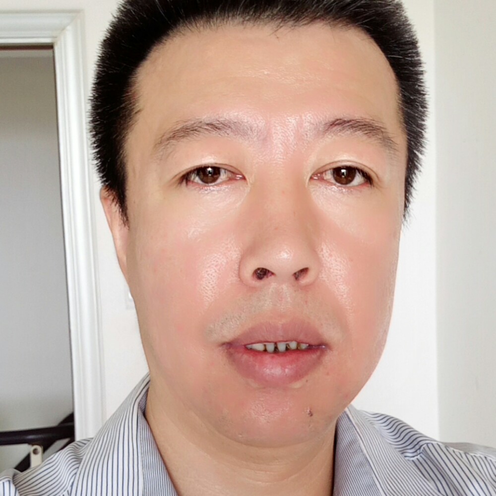 内向迎小土豆的照片