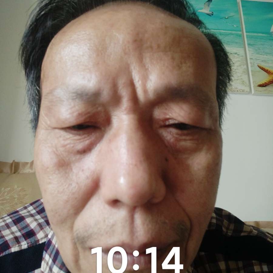淡淡蹙眉酒窝的照片