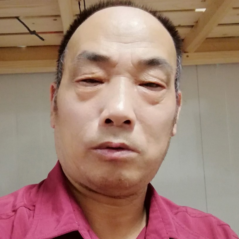 瘦瘦凝眸冬耀的照片