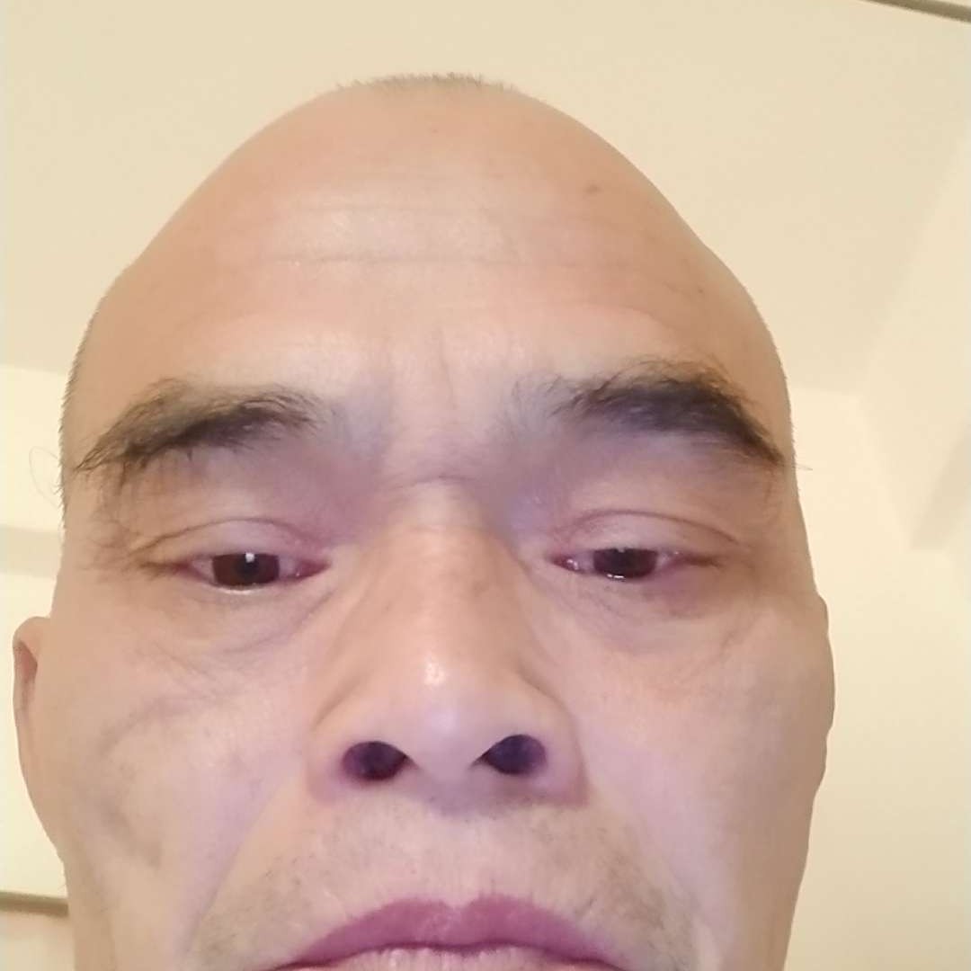 矮小浅吻草莓的照片