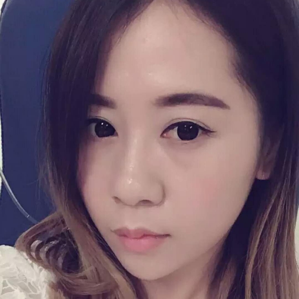 小鱼子酱的照片