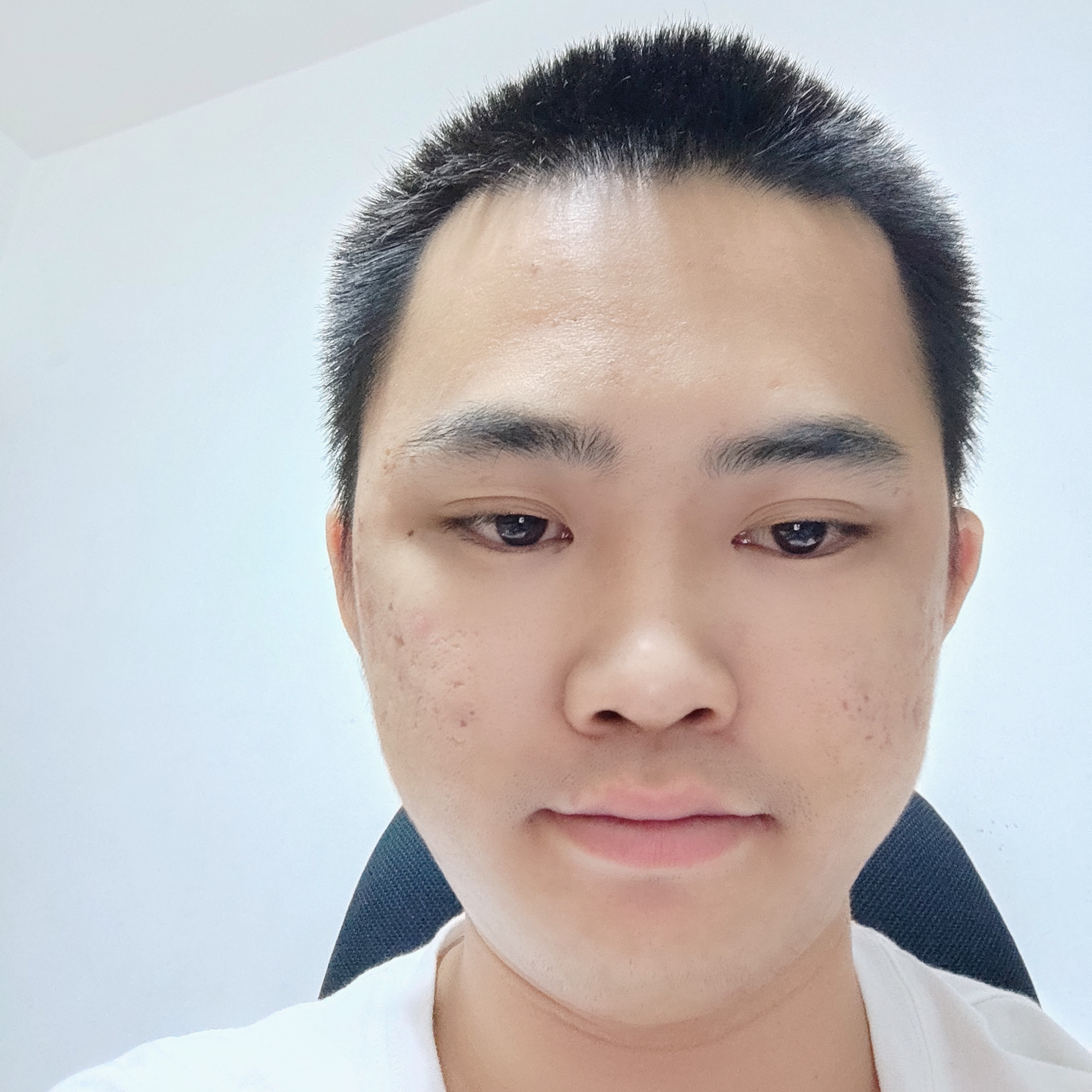 MECT的照片
